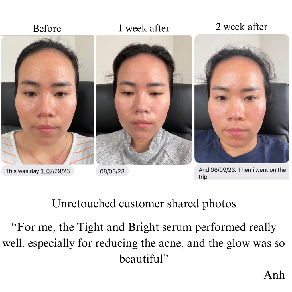 Tight & Bright Retinol + Vitamin C Serum