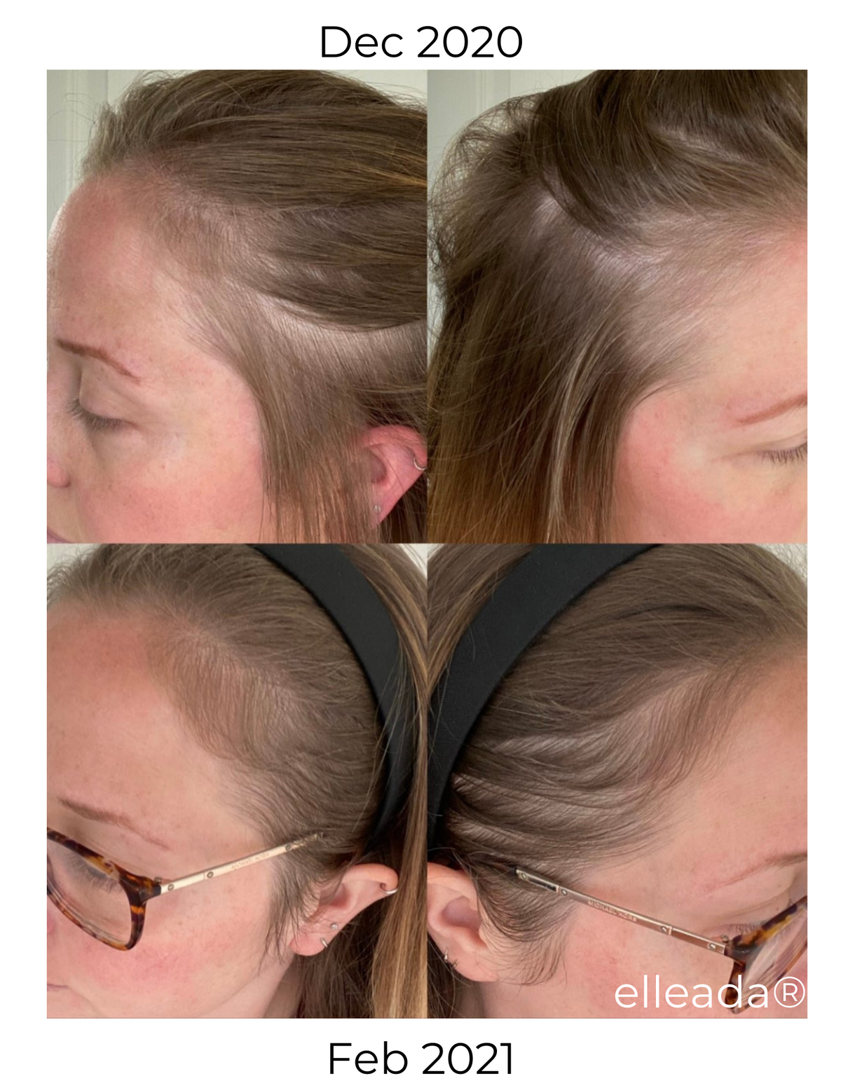 Elleada Nourishing Hair Serum