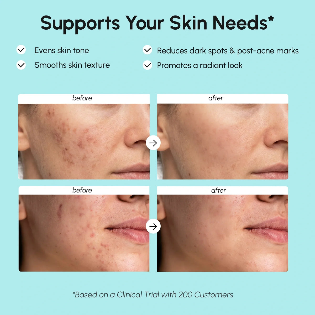 Azelaic Acid Calming Cream