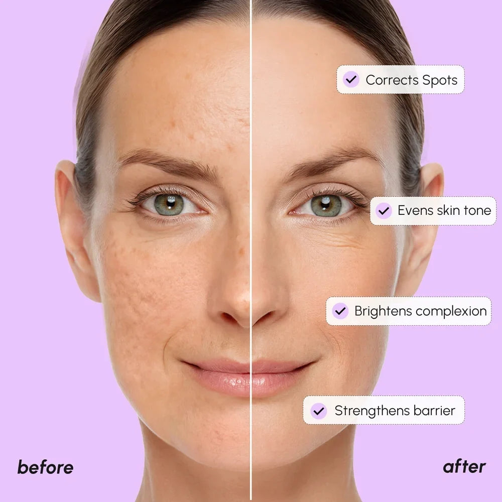 Tranexamic Acid Brightening Serum