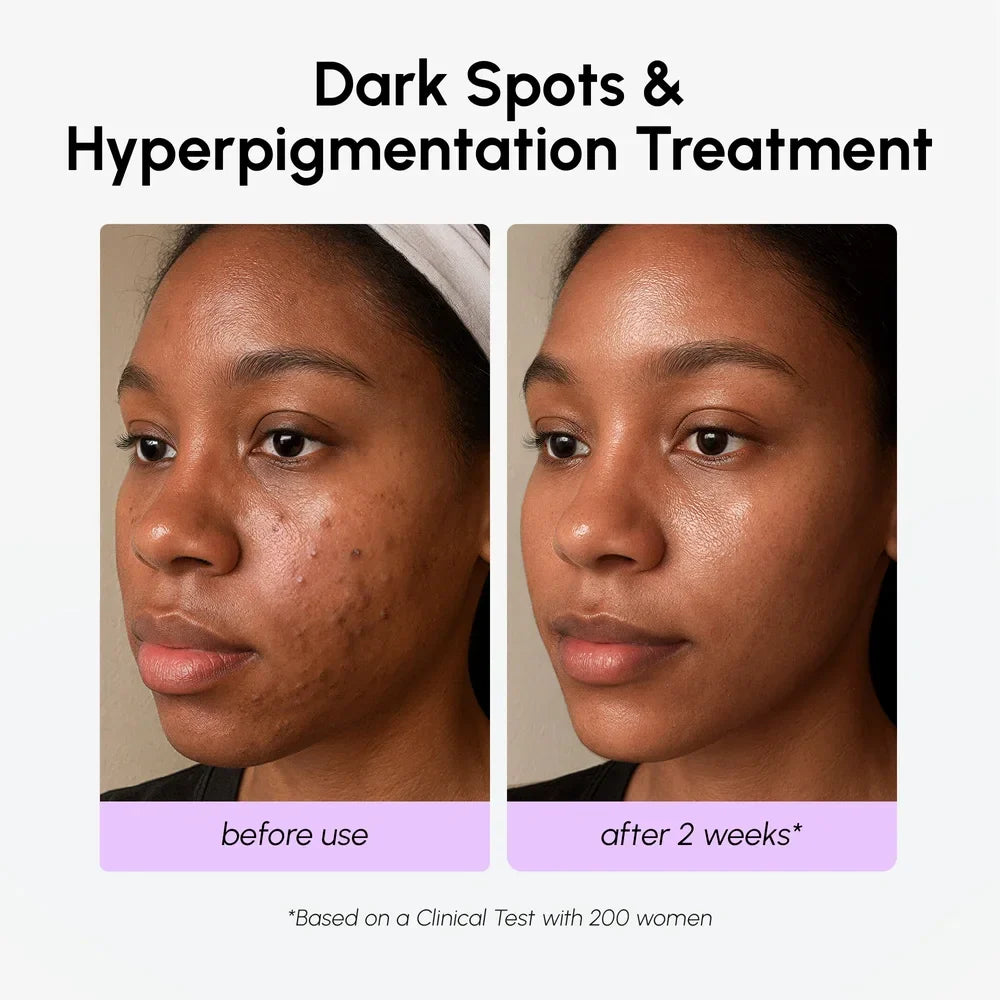 Tranexamic Acid Brightening Serum
