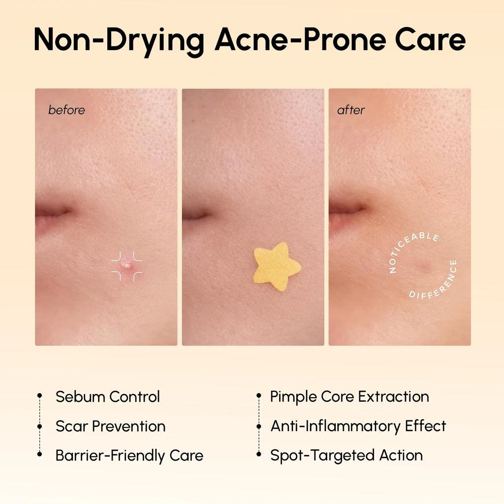 Gold Star Blemish Patches