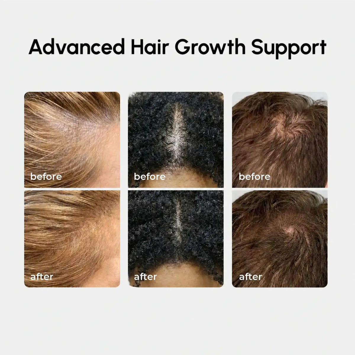 4-in-1 Scalp & Hair Spray