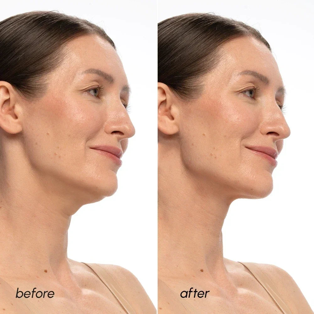 PDRN V-Line Lifting Mask