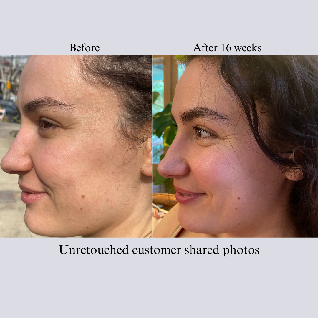 Tight & Bright Retinol + Vitamin C Serum