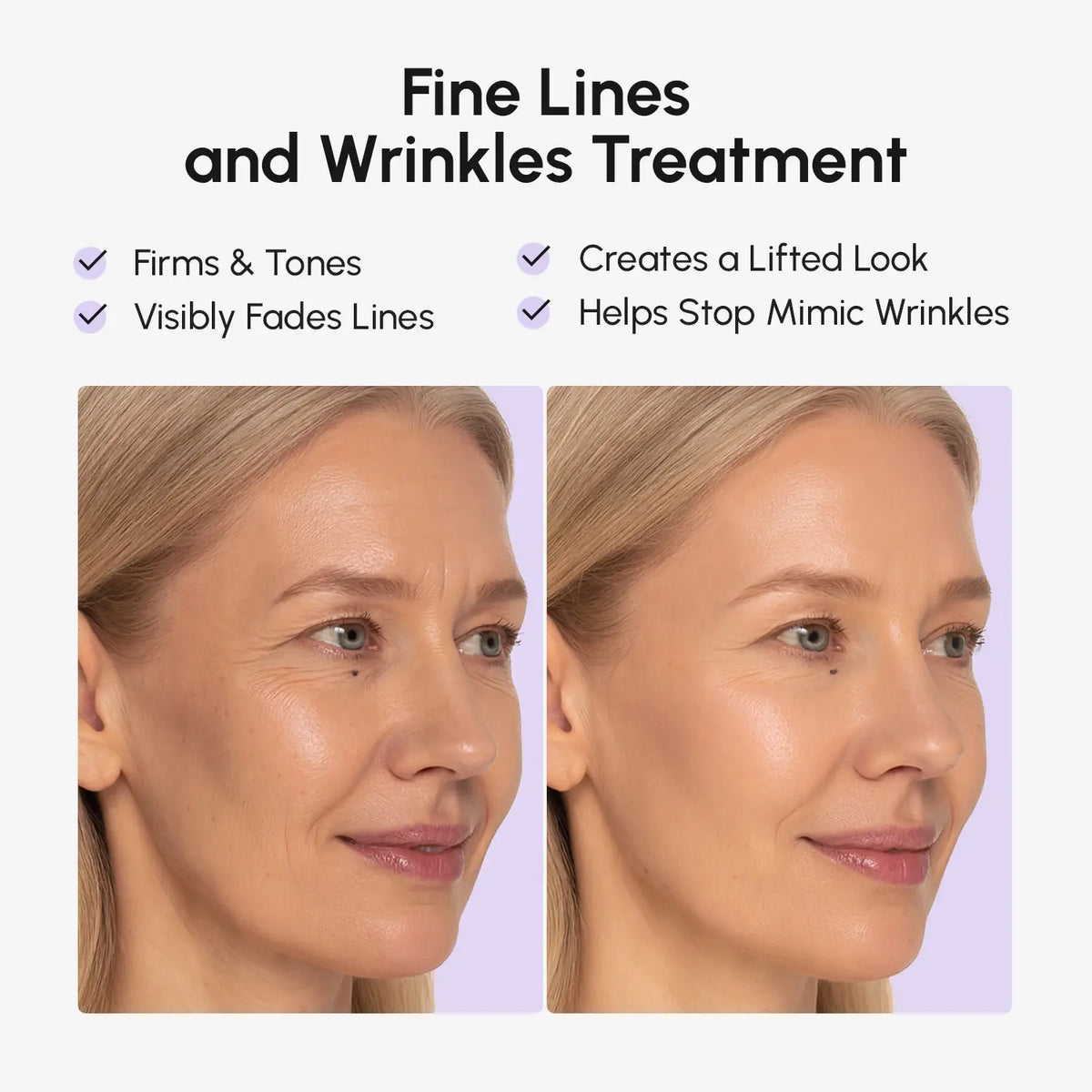 Face Smoothing Tape Patches